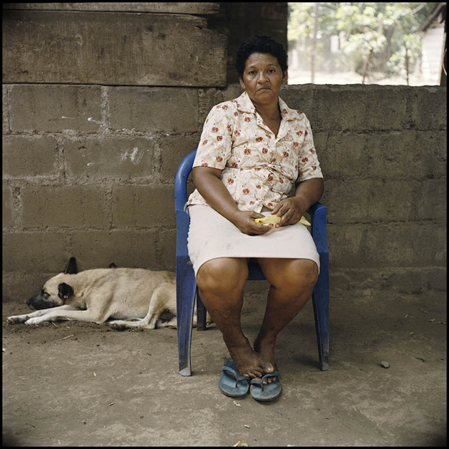 Chinandega, Nicaragua Francisca Picado Briceño, Pesticide affected woman, 47 Francisca mother of Juan Carlos worked on plantations for 15 years. She suffers from bone pains; she is slowly losing her sight and hasn’t worked in 9 years due to headaches, and the pain in her bones. The woman has 6 children, of them, one died at age 13, one is “slightly crazy” as she described it, and Juan Carlos, who suffers from severe psychological and physical problems. Her job on the farm was to fertilize the bananas, weigh them, package them, separating bunches, in all accounts she was constantly touching and handling the pesticide infected bananas. 